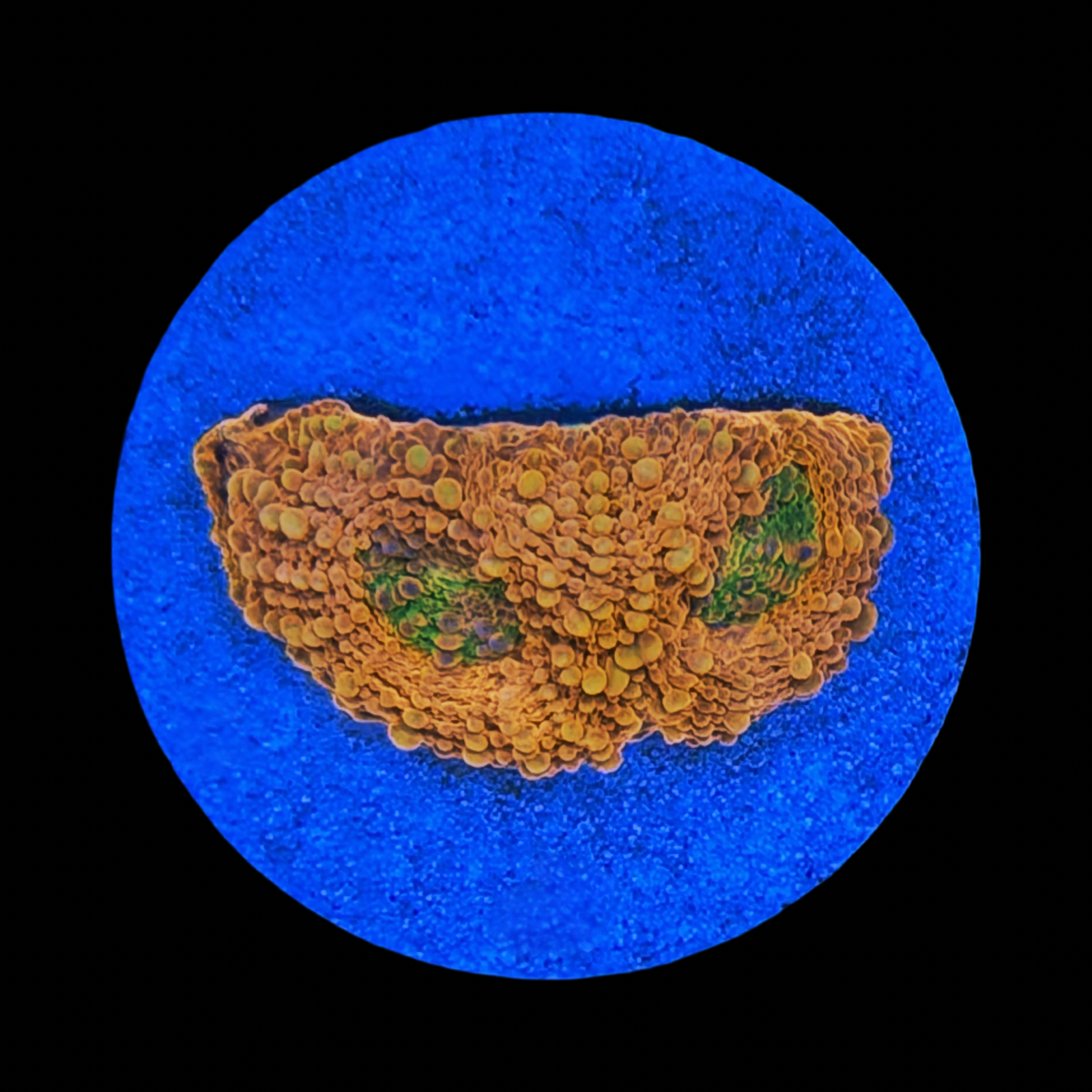 Ultra Orange Acan Echinata large plug